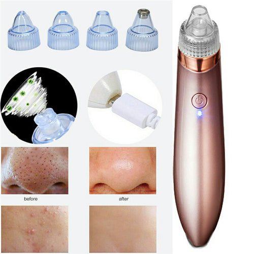 Rechargeable Blackhead Acne Oil Remover Vacuum Suction Face Pore Cleaner Facial Beauty Equipment,Blackhead Removal Machine