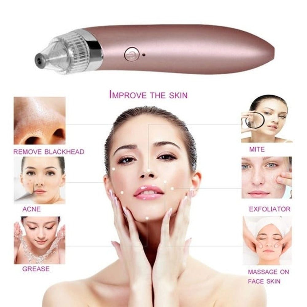 Rechargeable Blackhead Acne Oil Remover Vacuum Suction Face Pore Cleaner Facial Beauty Equipment,Blackhead Removal Machine