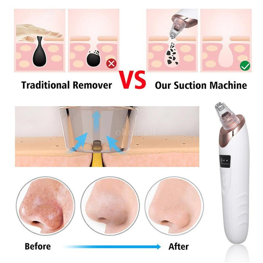Rechargeable Blackhead Acne Oil Remover Vacuum Suction Face Pore Cleaner Facial Beauty Equipment,Blackhead Removal Machine