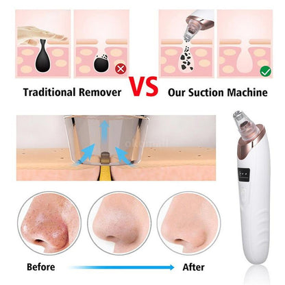 Rechargeable Blackhead Acne Oil Remover Vacuum Suction Face Pore Cleaner Facial Beauty Equipment,Blackhead Removal Machine